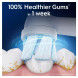 Сменные насадки для зубной щетки Oral-B iO Gentle Care (4 шт.) в Чебоксарах